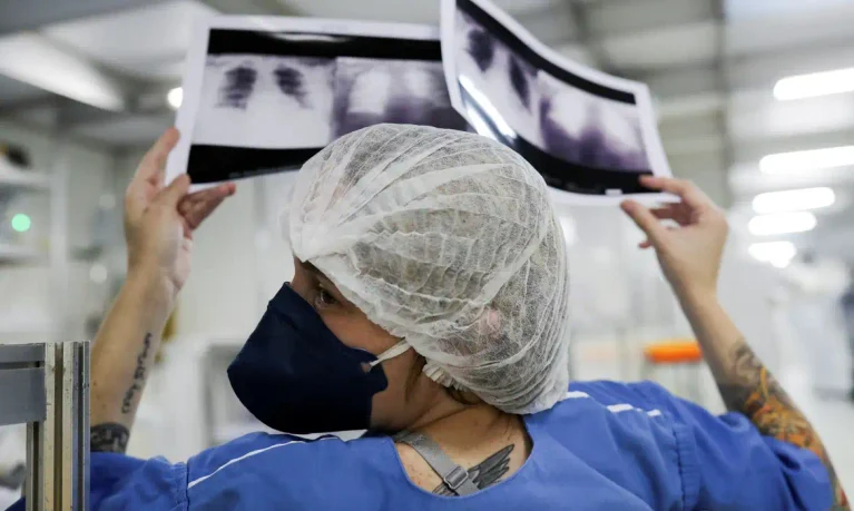 _radiografia_de_torax_coronaviruscovid-19_hospital_sao_paulo1205200325